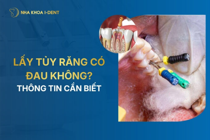 lấy tủy răng có đau không
