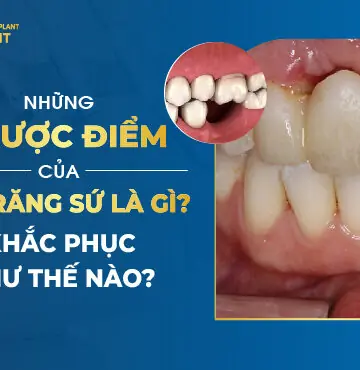 Những Nhược Điểm Của Cầu Răng Sứ Là Gì? Khắc Phục Như Thế Nào?