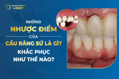 Những Nhược Điểm Của Cầu Răng Sứ Là Gì? Khắc Phục Như Thế Nào?