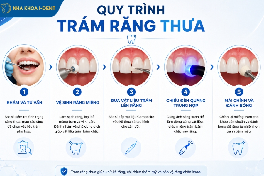 quy trình trám răng thưa