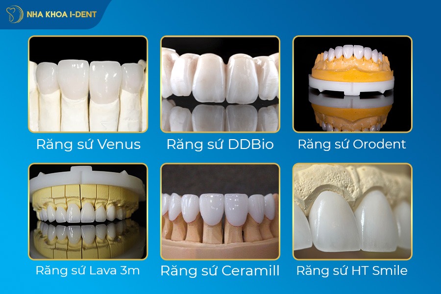 bọc răng sứ có vĩnh viễn không
