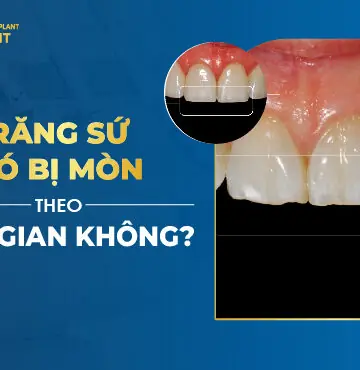 Răng Sứ Có Bị Mòn Theo Thời Gian Không?