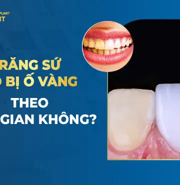 Răng Sứ Có Bị Ố Vàng Theo Thời Gian Không?