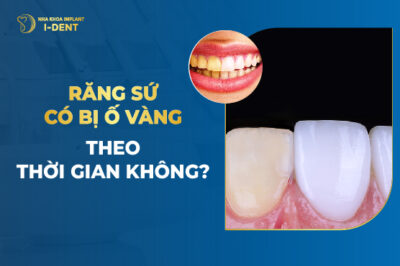 Răng Sứ Có Bị Ố Vàng Theo Thời Gian Không?