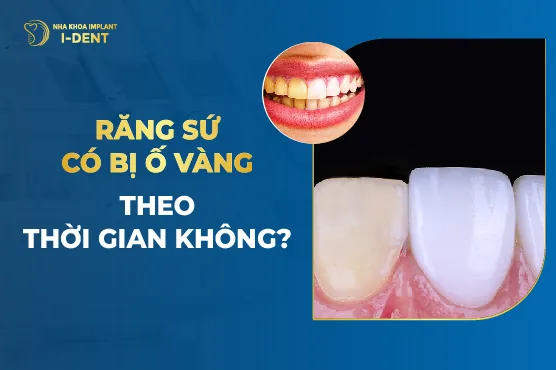 Răng Sứ Có Bị Ố Vàng Theo Thời Gian Không?