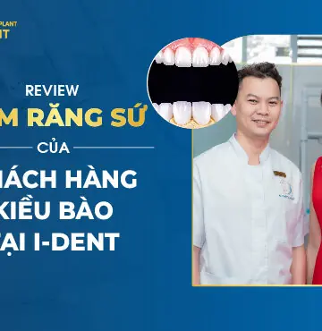 Review Làm Răng Sứ Của Khách Hàng Kiều Bào Tại I-DENT