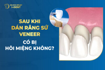 Sau Khi Dán Răng Sứ Veneer Có Bị Hôi Miệng Không?