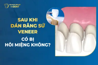 Sau Khi Dán Răng Sứ Veneer Có Bị Hôi Miệng Không?