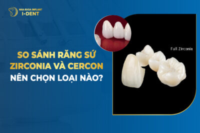 So Sánh Răng Sứ Zirconia Và Cercon - Nên Chọn Loại Nào?