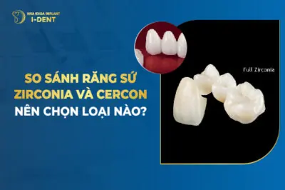 So Sánh Răng Sứ Zirconia Và Cercon - Nên Chọn Loại Nào?
