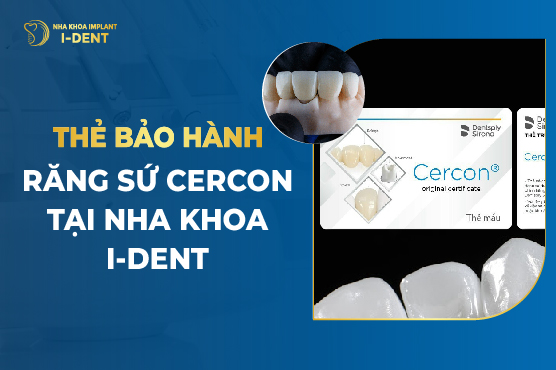 Thẻ bảo hành răng sứ Cercon HT có hiệu lực khi nào?
