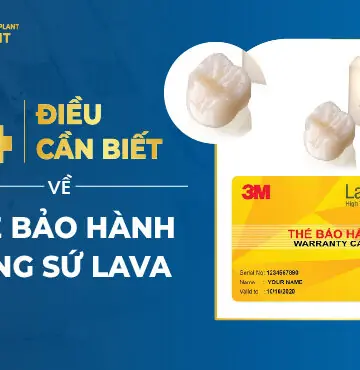 4 Điều Cần Biết Về Thẻ Bảo Hành Răng Sứ Lava