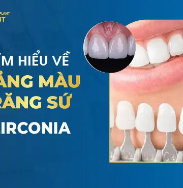 Tìm Hiểu Về Bảng Màu Răng Sứ Zirconia