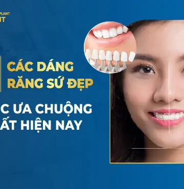 Top 9 Các Dáng Răng Sứ Đẹp Được Ưa Chuộng Nhất Hiện Nay