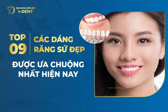 Top 9 Các Dáng Răng Sứ Đẹp Được Ưa Chuộng Nhất Hiện Nay