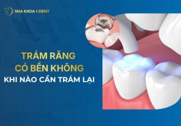 trám răng có bền không