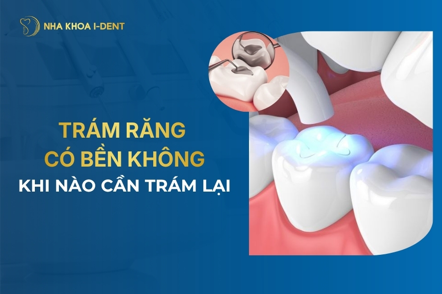 trám răng có bền không