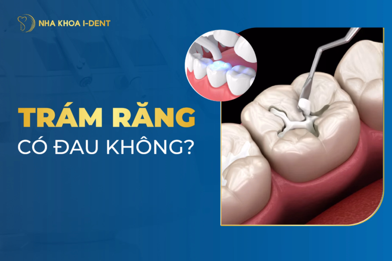 trám răng có đau không