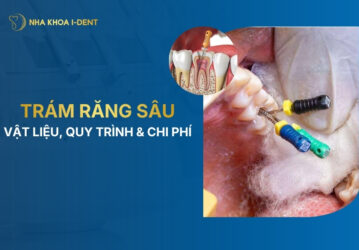 trám răng sâu