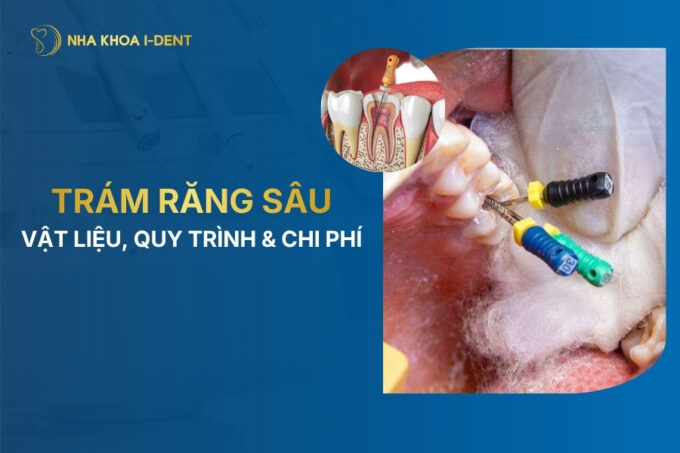 trám răng sâu