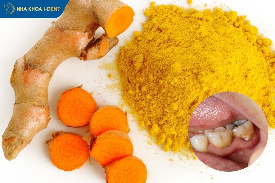 trị sâu răng tại nhà