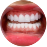 Dịch vụ nha khoa thẩm mỹ tại nha khoa I-Dent.