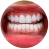 Dịch vụ nha khoa thẩm mỹ tại nha khoa I-Dent.