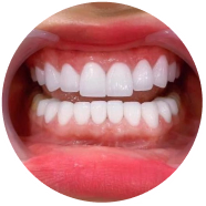 Dịch vụ nha khoa thẩm mỹ tại nha khoa I-Dent.