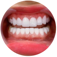 Dịch vụ nha khoa thẩm mỹ tại nha khoa I-Dent.