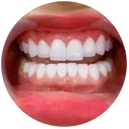 Dịch vụ nha khoa thẩm mỹ tại nha khoa I-Dent.