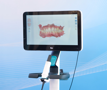Nha khoa I-Dent sở hữu máy scan răng Itero Lumina hiện đại nhất thế giới.
