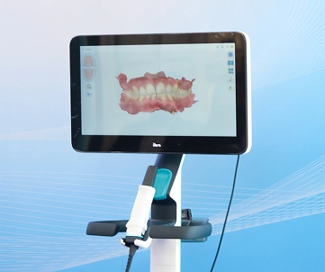 Nha khoa I-Dent sở hữu máy scan răng Itero Lumina hiện đại nhất thế giới.