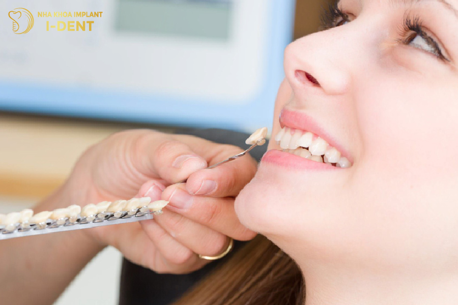 Bọc sứ giúp cải thiện răng hô nhẹ không cần niềng