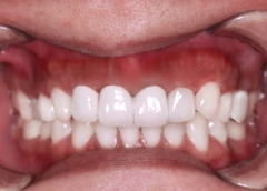 Chị Quỳnh Như S 100