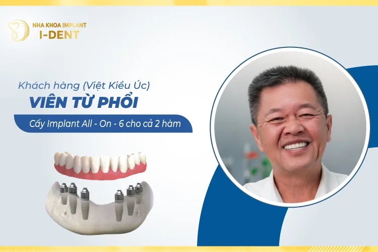 CHÚ VIÊN TỬ PHỐI (VIỆT KIỀU ÚC)