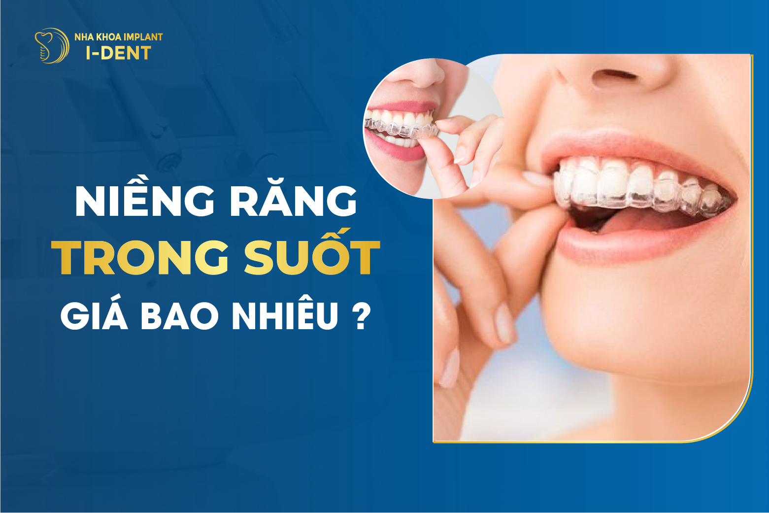 Niềng Răng Trong Suốt Giá Bao Nhiêu Tiền?