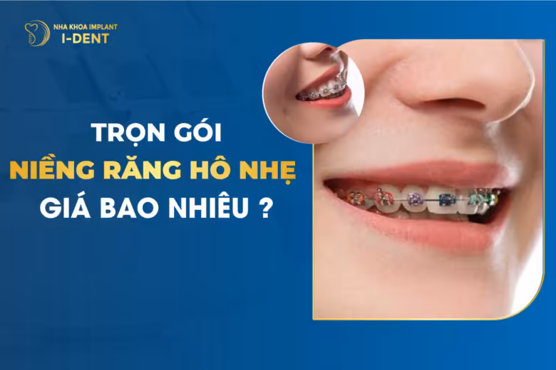 Trọn Gói Niềng Răng Hô Giá Bao Nhiêu?