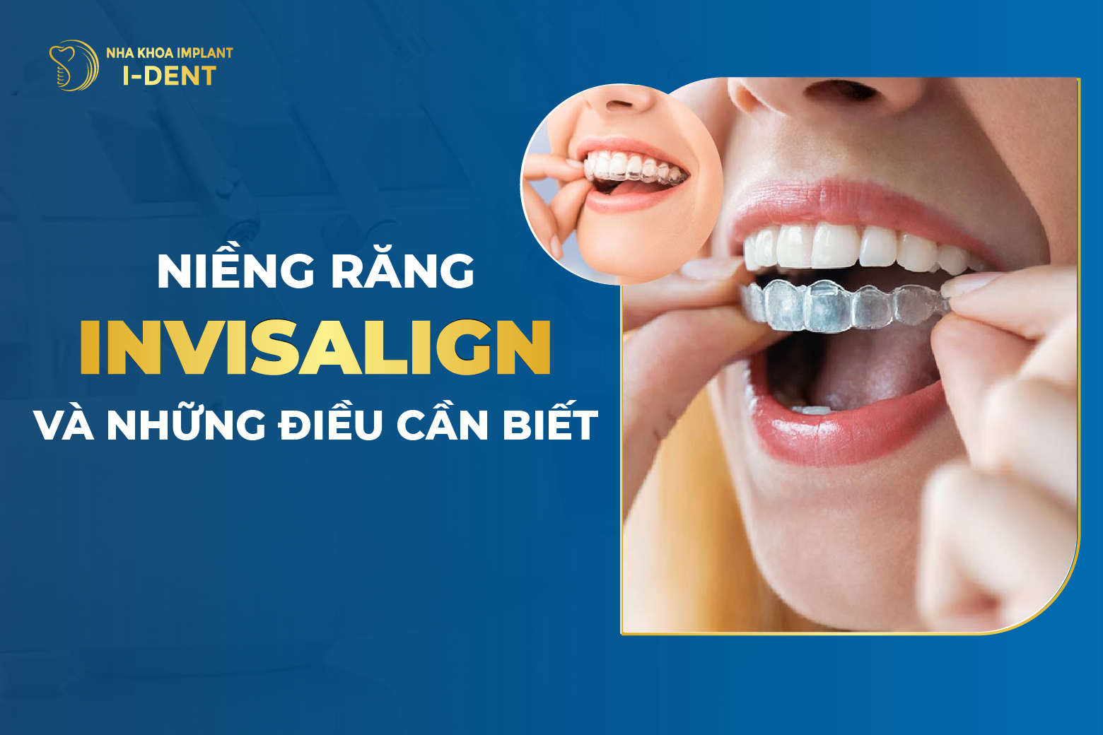 Niềng Răng Invisalign Có Hiệu Quả Không Có Đau Không 3792