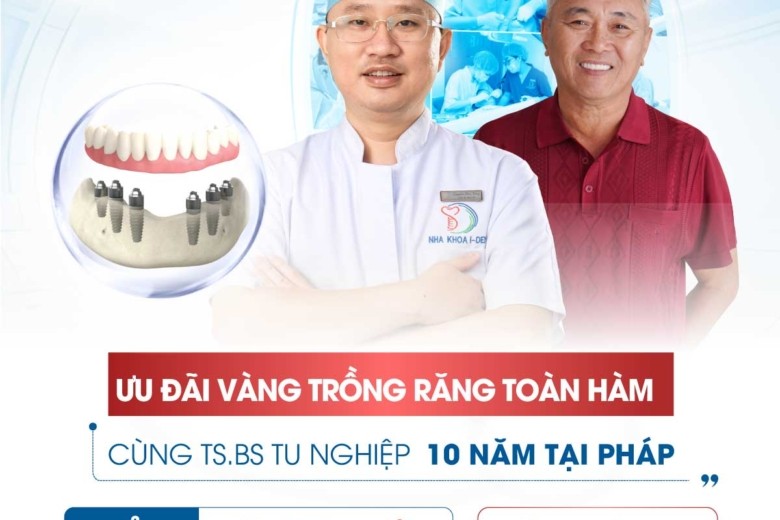 Bảng Giá Implant Toàn Hàm Trọn Gói