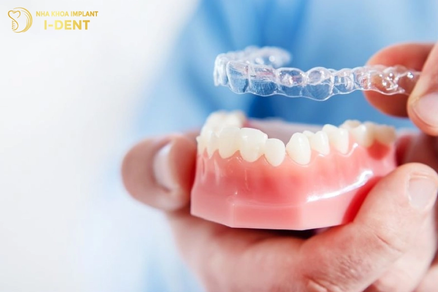 Mỗi nha khoa sẽ có bảng giá niềng răng trong suốt khác nhau