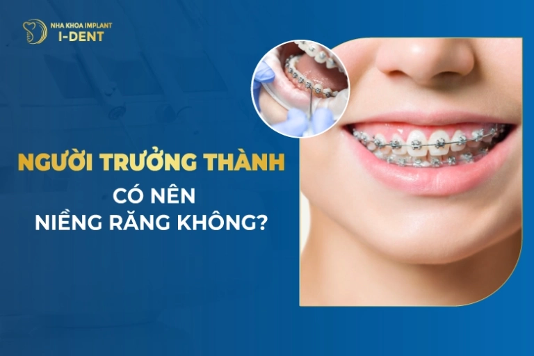 Người Trưởng Thành Có Nên Niềng Răng Không