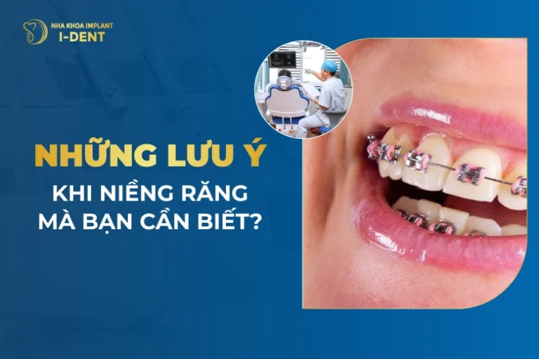 Nhung-Luu-Y-Khi-Nieng-Rang-Ma-Ban-Can-Biet