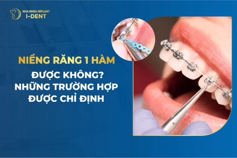 niềng răng 1 hàm
