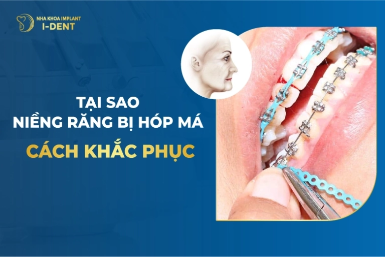 Niềng răng bị hóp má? Cách khắc phục