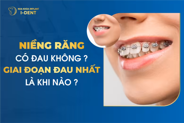 Niềng Răng Có Đau Không? Giai Đoạn Đau Nhất Là Khi Nào?