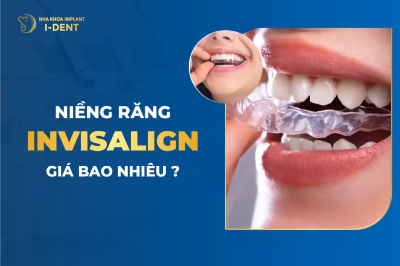 Niềng Răng Invisalign Giá Bao Nhiêu?