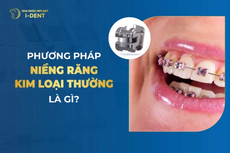 Phuong-Phap-Nieng-Rang-Kim-Loai-Thuong-La-Gi