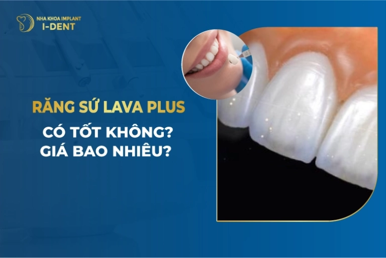 Răng Sứ Lava Plus Là Gì? Có Tốt Không? Giá Bao Nhiêu