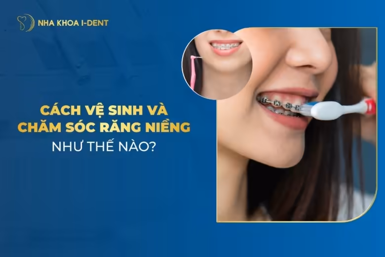 Cách Vệ Sinh Và Chăm Sóc Răng Miệng Khi Niềng Răng