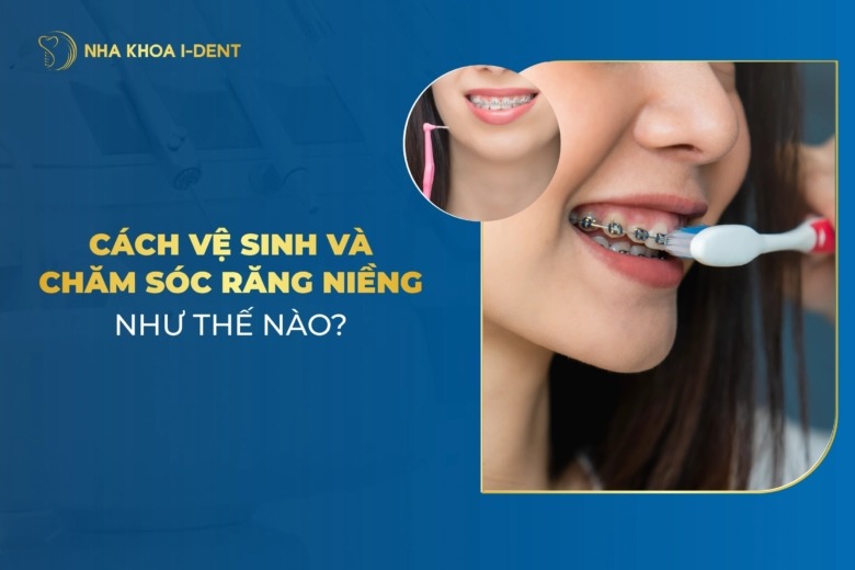 Cách Vệ Sinh Và Chăm Sóc Răng Niềng Như Thế Nào?